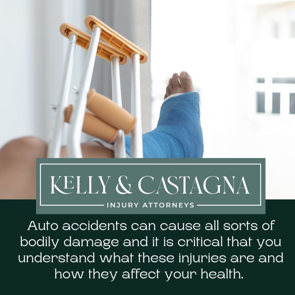 Car Accident Lawyer Normal Illinois | Kelly and Castagna | Car Accident Lawyer Near Me